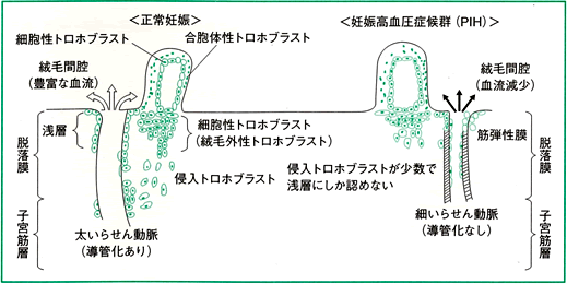 病気の起こる原因